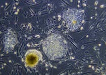 The round masses in this microscopic view are stem cell coloinies.